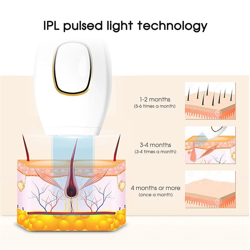 Laser Hair Removal  Epilator